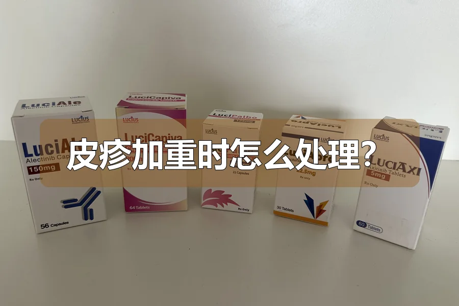 皮疹加重时怎么处理?